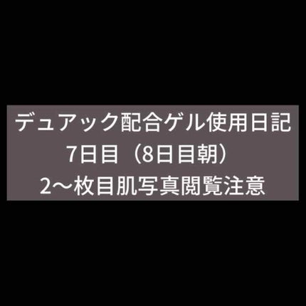 デュアック配合ゲル/ポーラファルマ/その他を使ったクチコミ(1枚目)