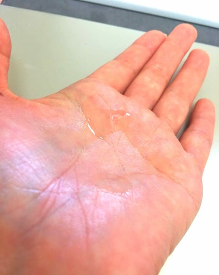 バイオイル/バイオイル/フェイスオイルを使ったクチコミ(2枚目)