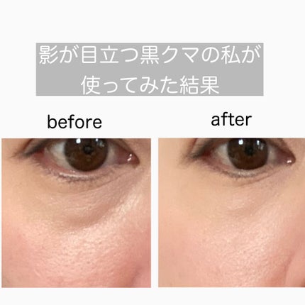 トーンパーフェクティング パレット/DECORTÉ/パレットコンシーラーを使ったクチコミ(4枚目)