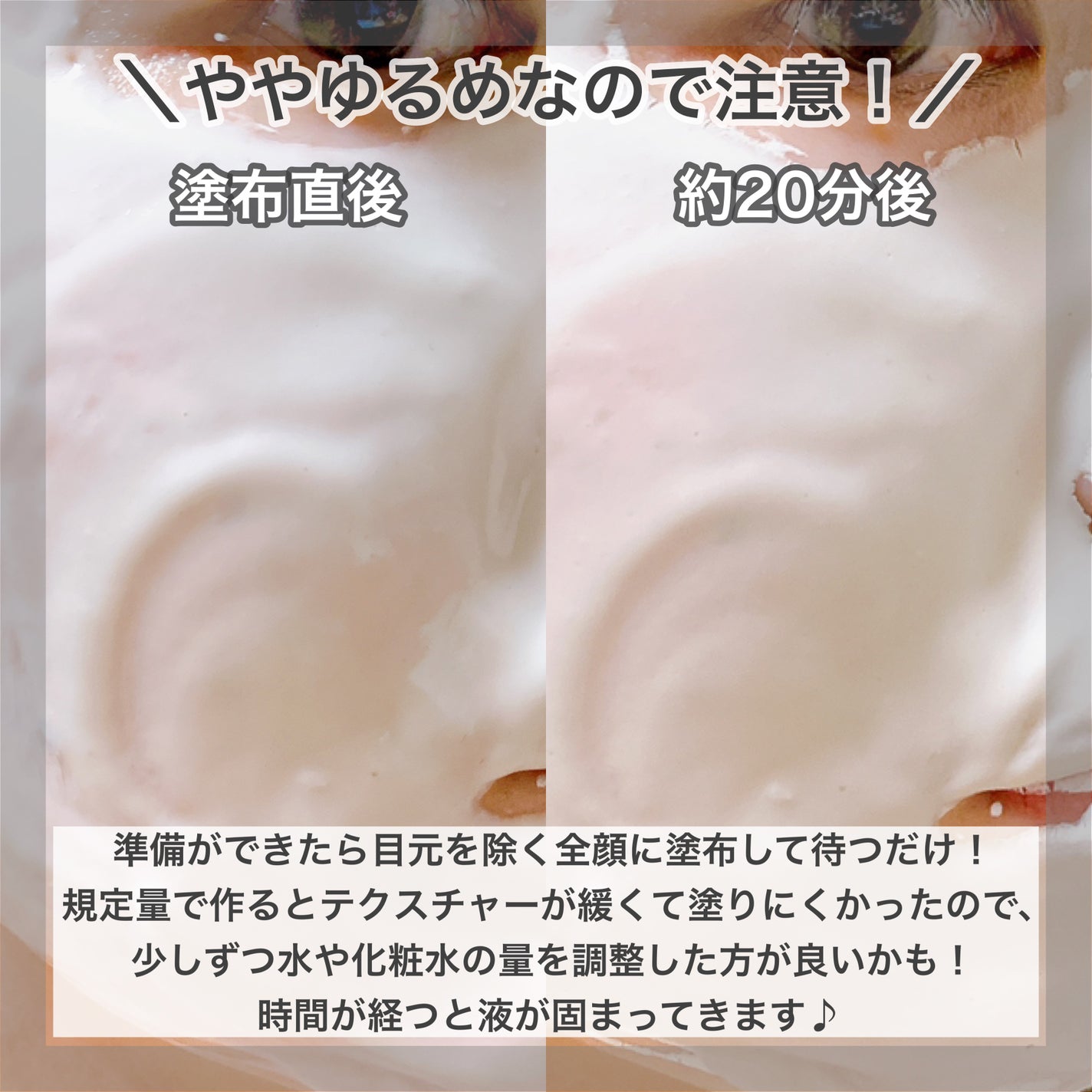 ドクダミ化粧水/ONE THING/化粧水を使ったクチコミ(6枚目)