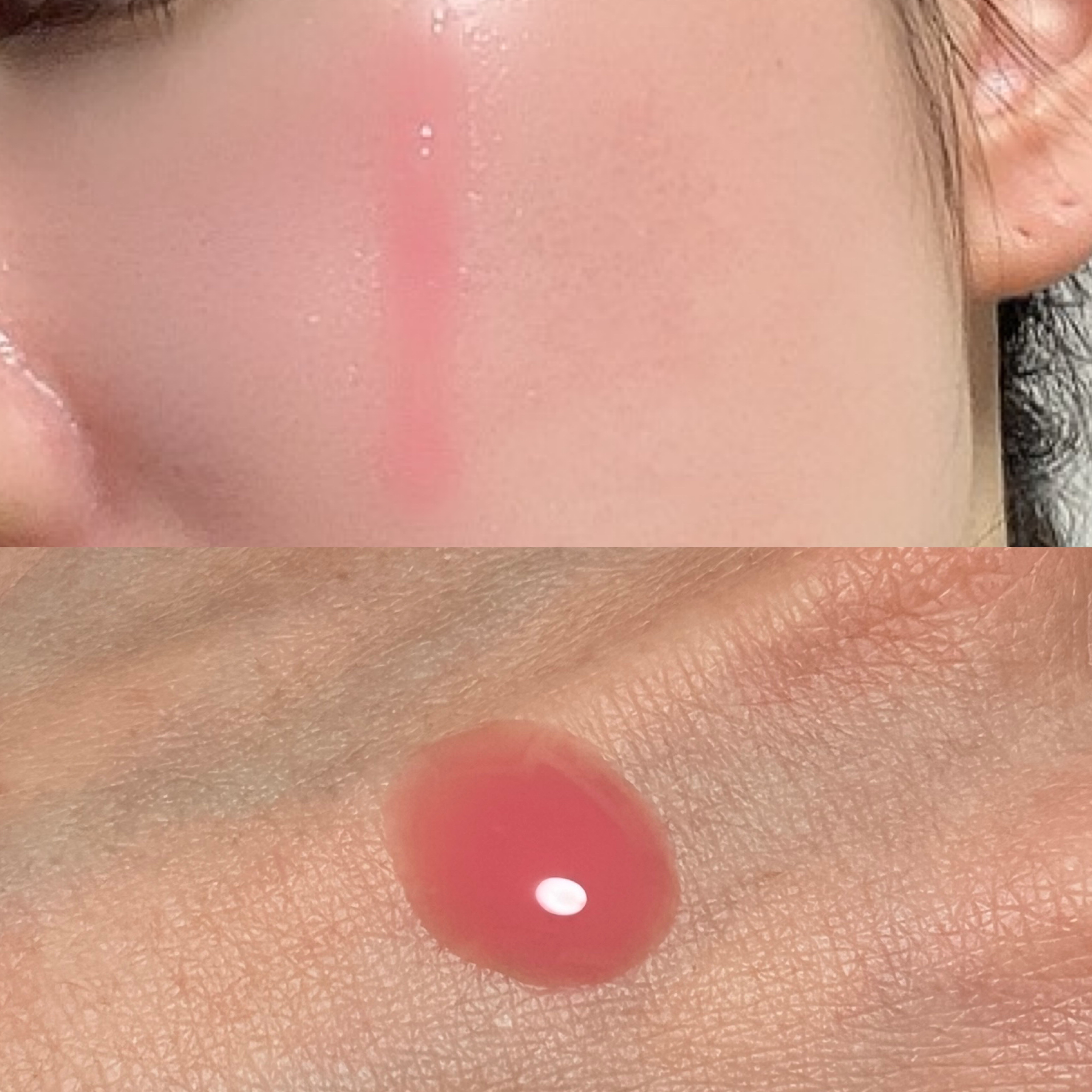 PDRNピンクアンプル PDRN 10,000ppm配合/MEDICUBE/美容液を使ったクチコミ（3枚目）