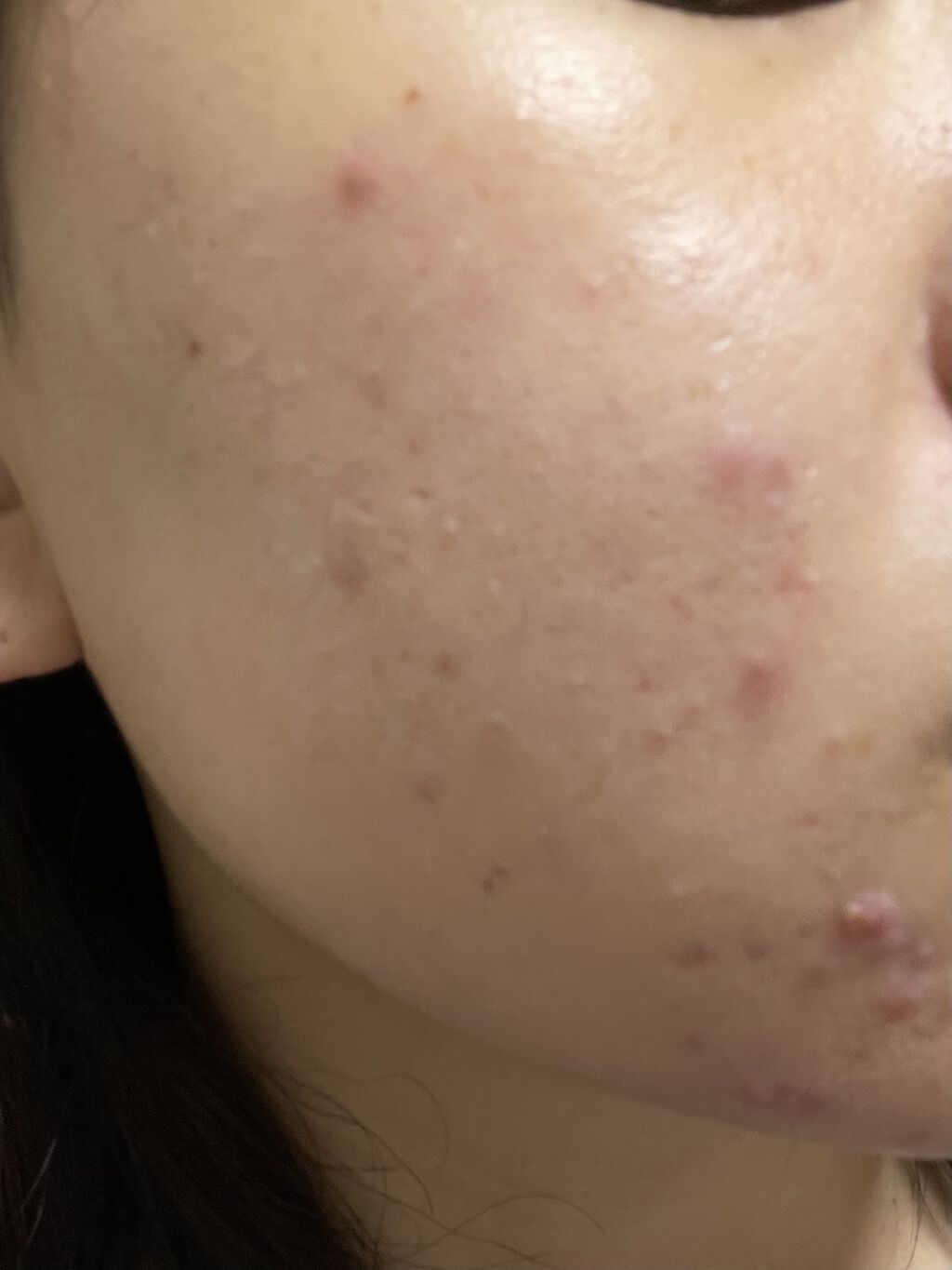 ハトムギ保湿ジェル(ナチュリエ スキンコンディショニングジェル)/ナチュリエ/美容液を使ったクチコミ（3枚目）