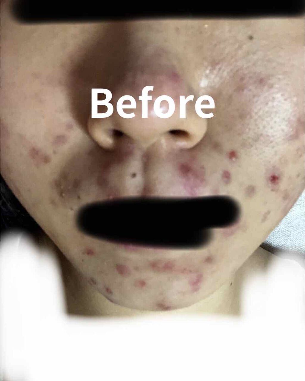 ジョンソン ベビーローション/ジョンソンベビー/ボディローションを使ったクチコミ（2枚目）