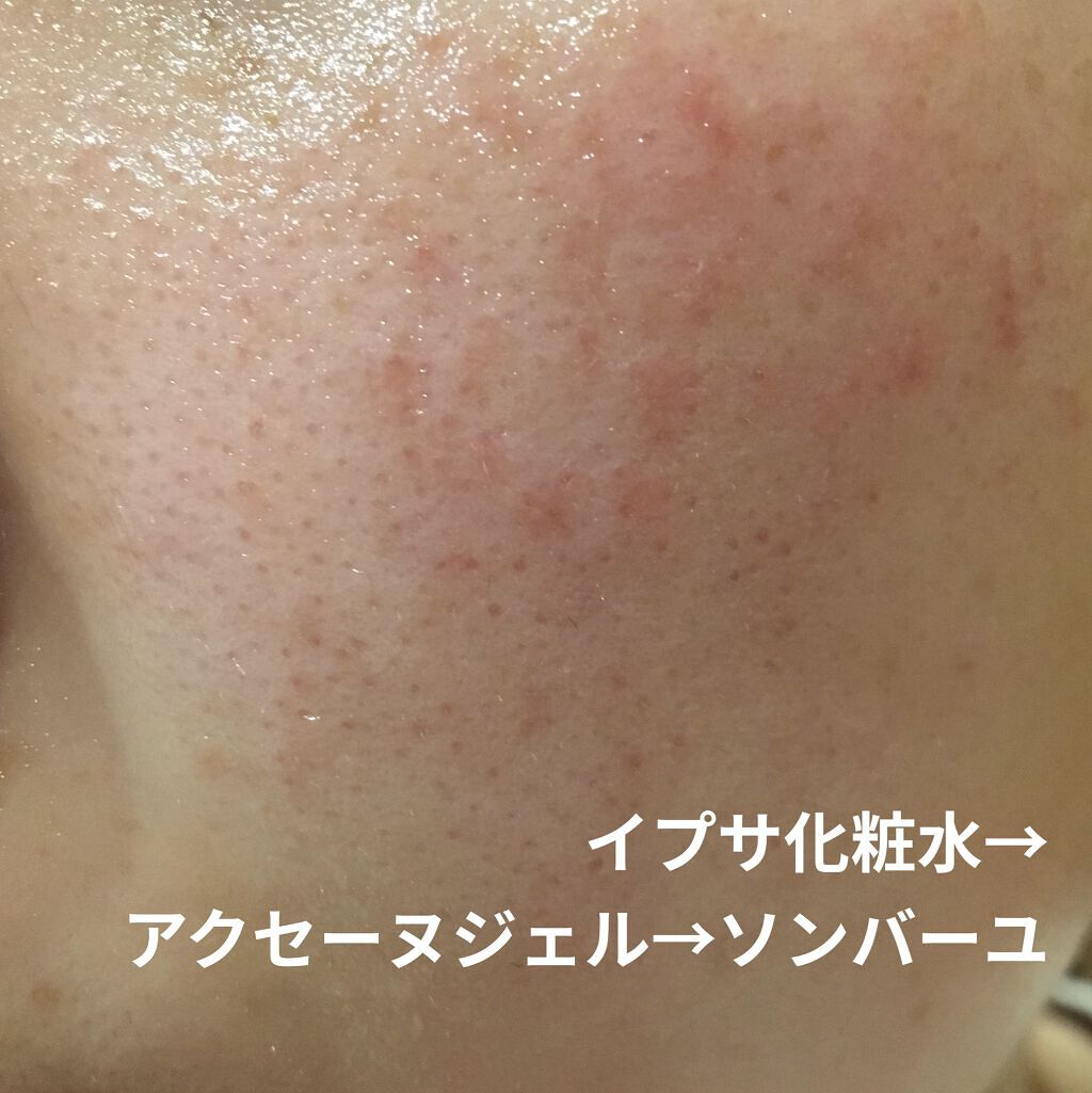 モイストバランス ジェル/ACSEINE/美容液を使ったクチコミ（1枚目）