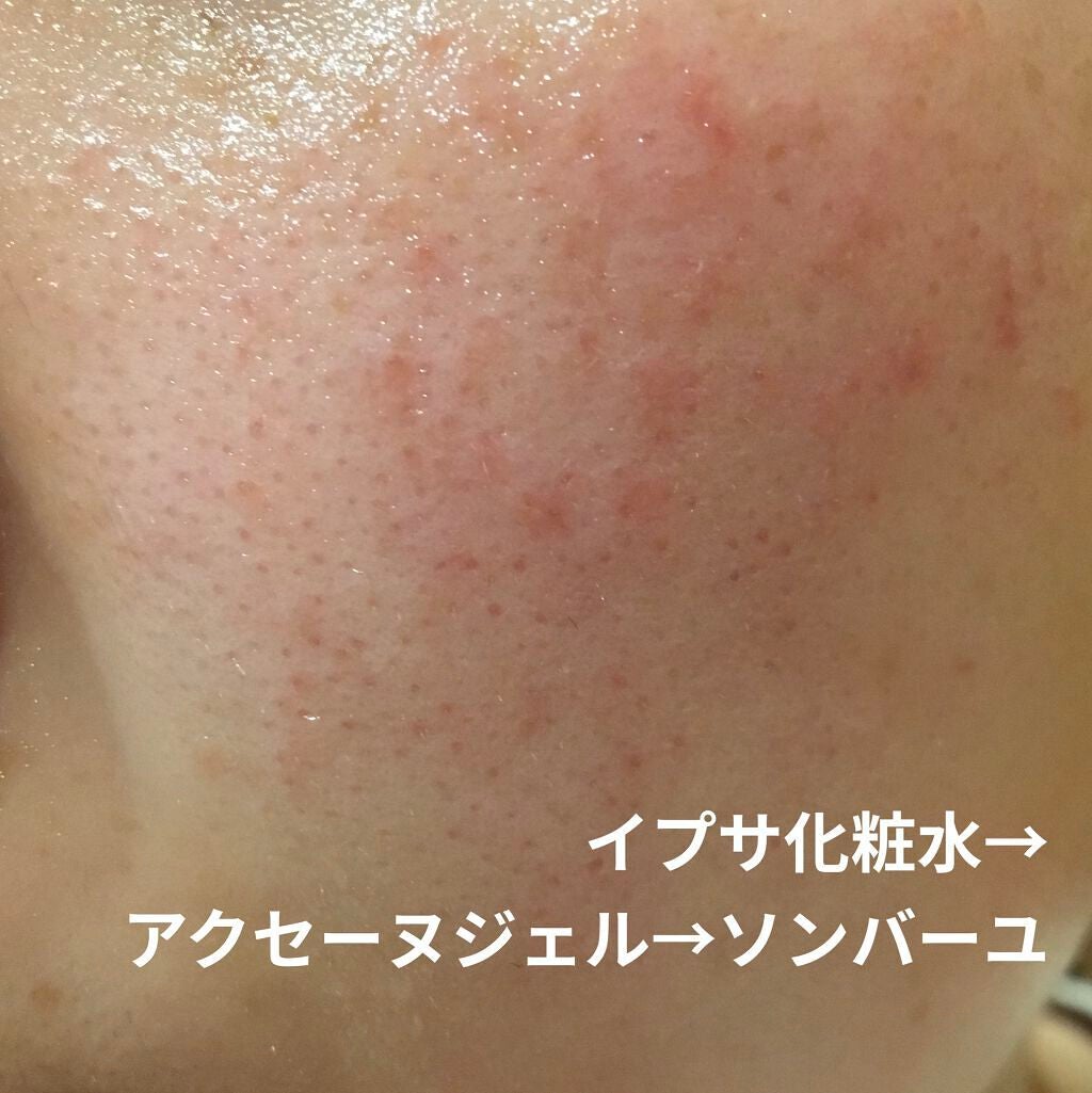 モイストバランス ジェル/ACSEINE/美容液を使ったクチコミ(1枚目)