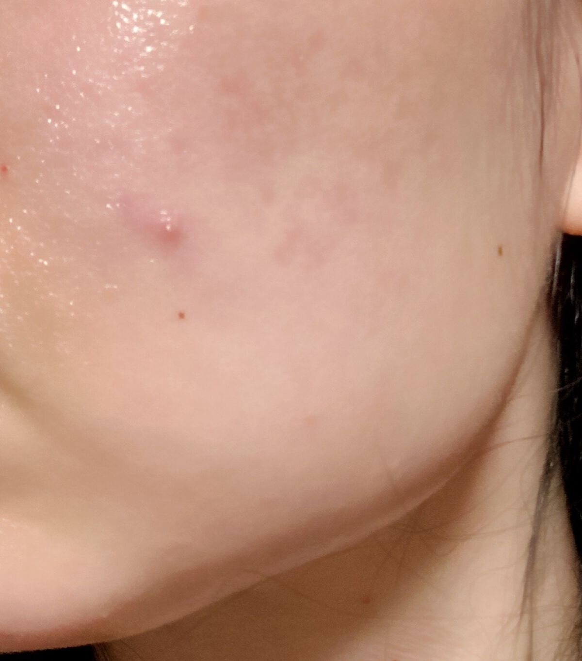 薬用ローション（とてもしっとり）/IHADA/化粧水を使ったクチコミ（2枚目）