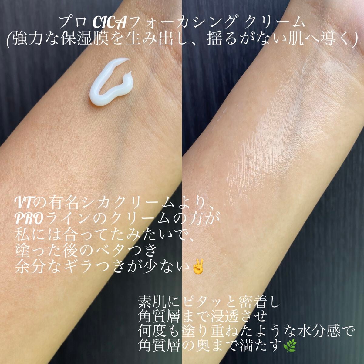 プロ シカ センテラ アジアティカ タイガー スキン/VT/化粧水を使ったクチコミ(9枚目)