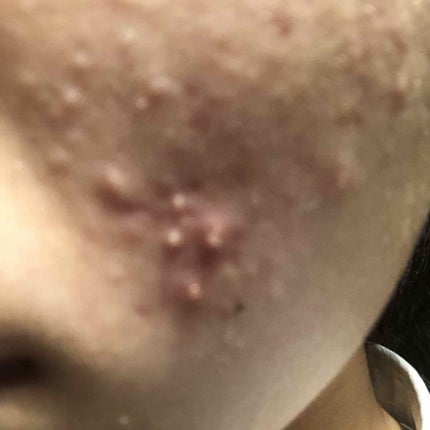 ビジャ シカバーム EX/innisfree/フェイスバームを使ったクチコミ(3枚目)