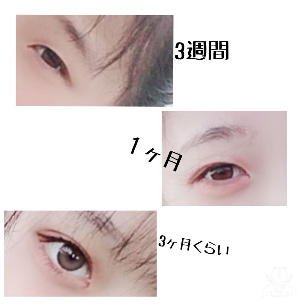 アイトーク/アイトーク/二重まぶた用アイテムを使ったクチコミ(2枚目)