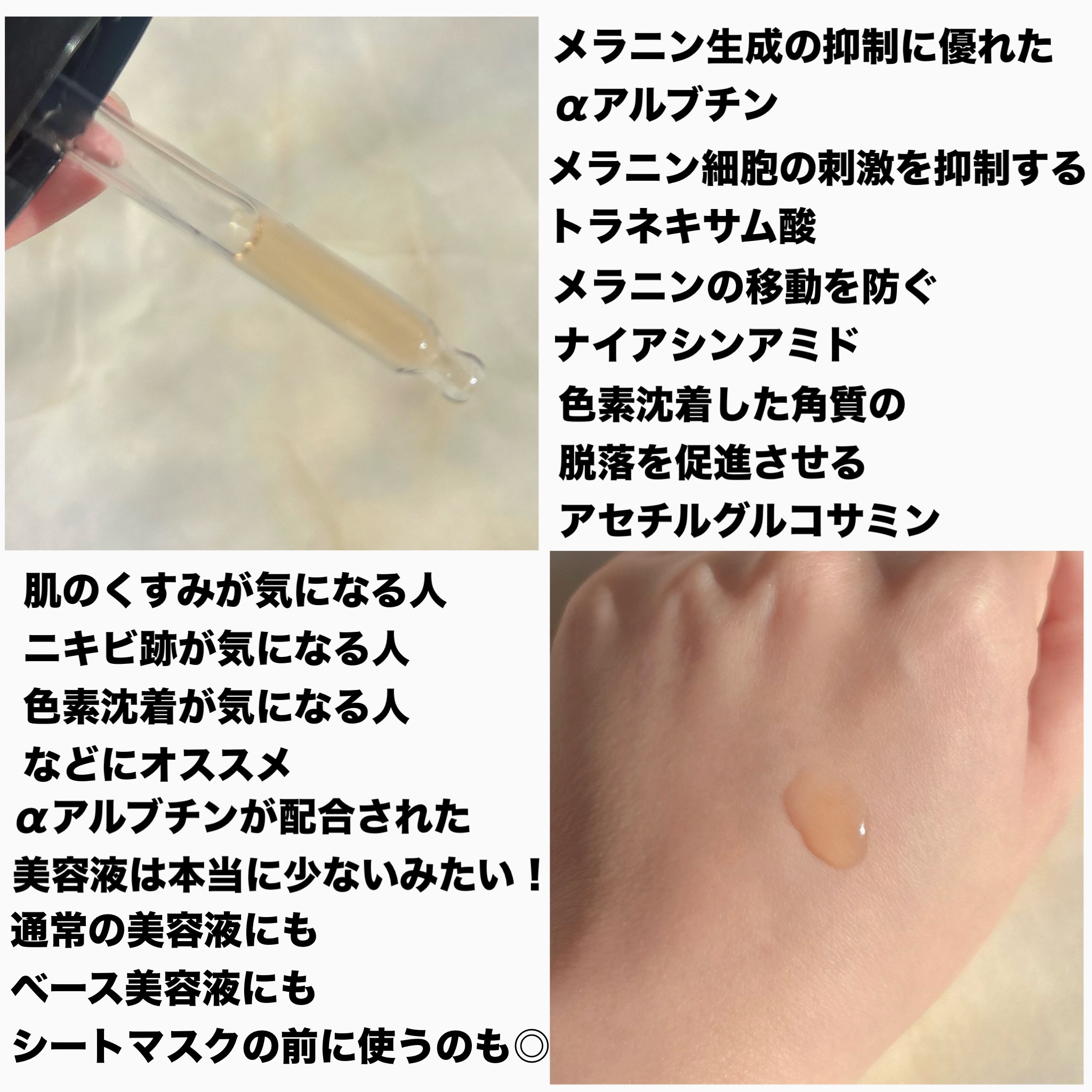 RXザ・アルファアルブチン2 ニキビ跡ケアセラム/COSRX/美容液を使ったクチコミ（2枚目）