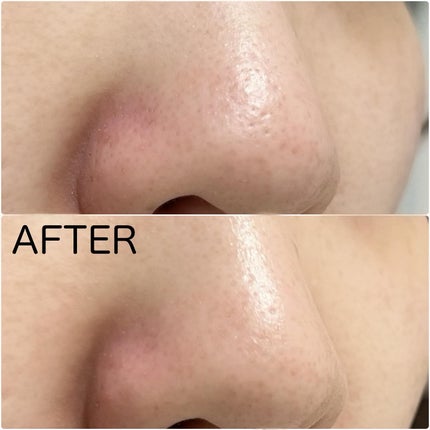 ナチュラルマイルドクリアノーズパック/ilso/シートマスク・パックを使ったクチコミ(7枚目)