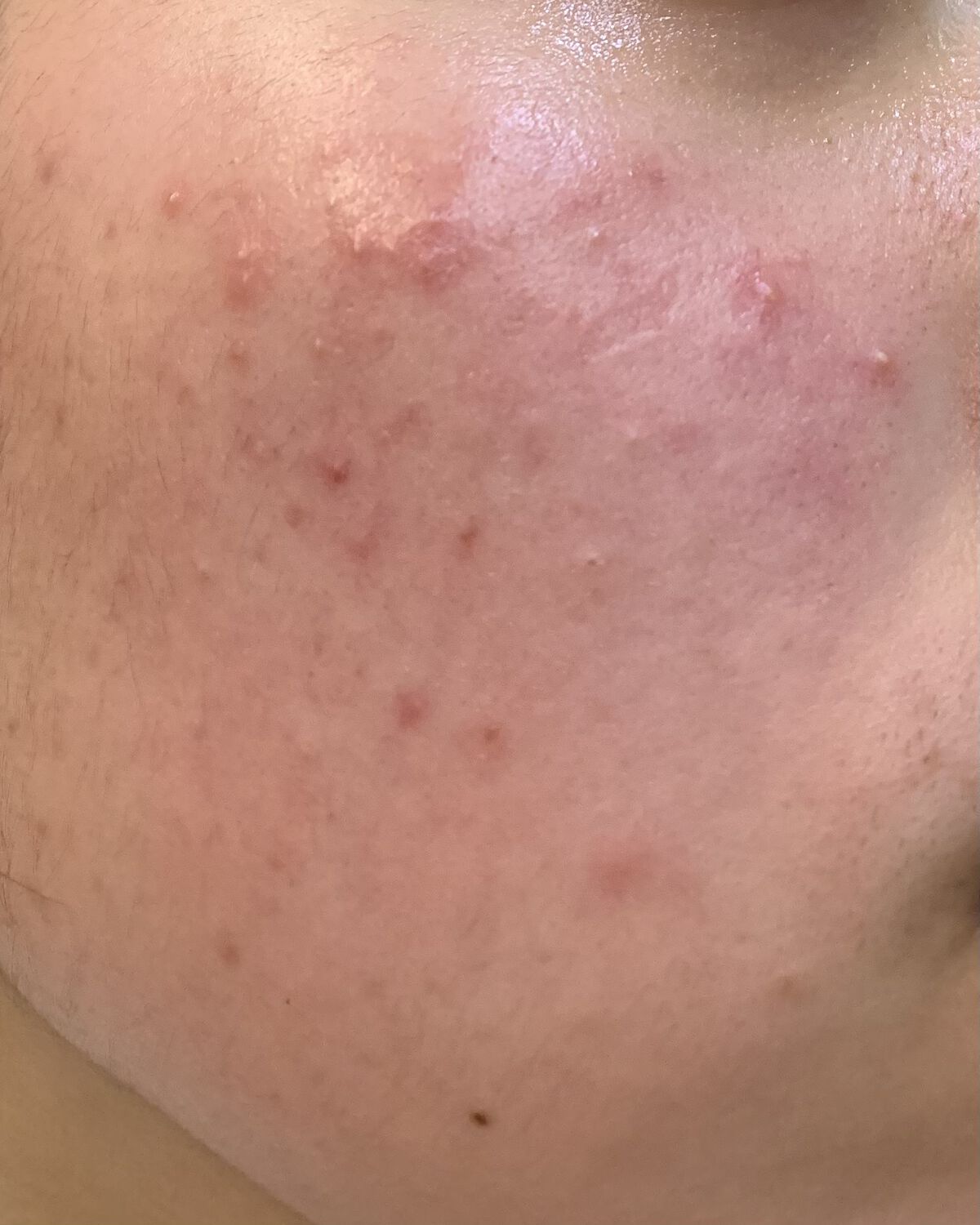 ドクダミ 77 スージングトナー/Anua/化粧水を使ったクチコミ（2枚目）