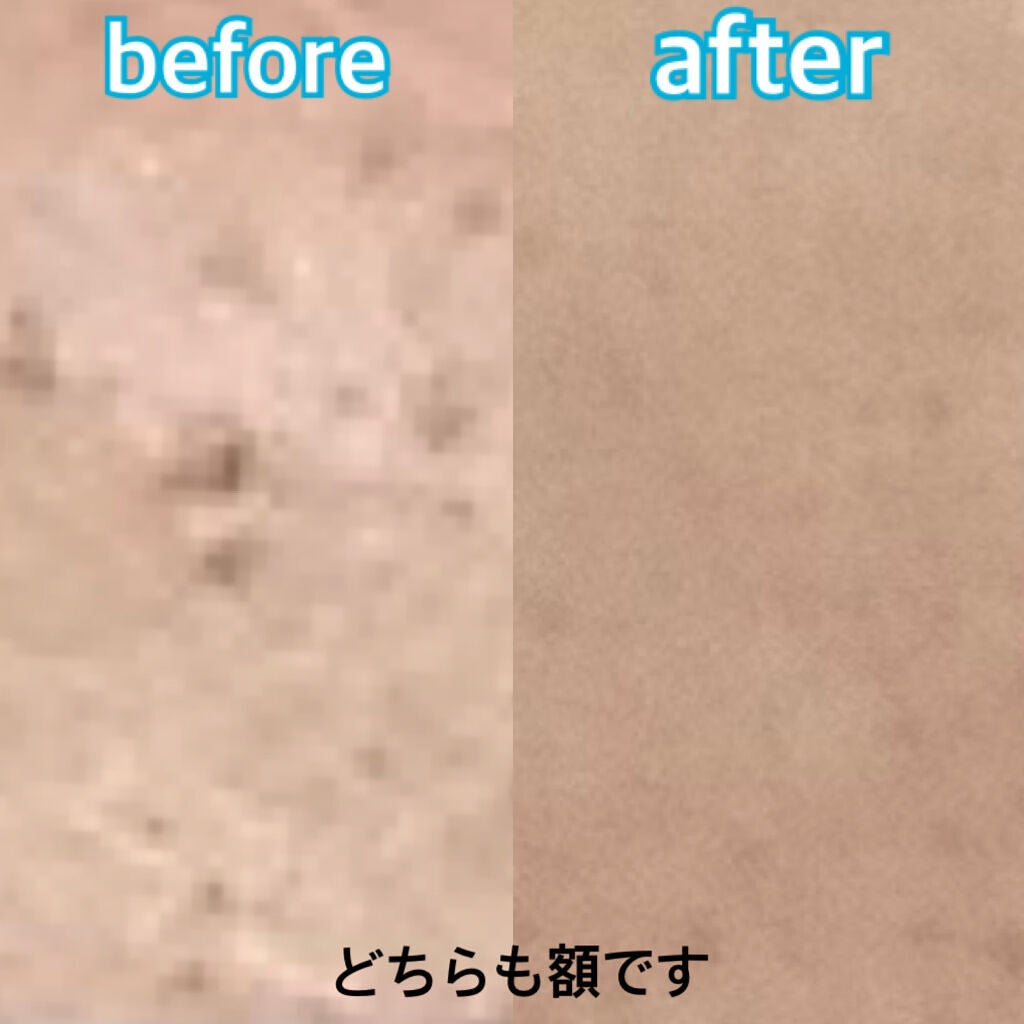 チョコラBBピュア (医薬品)/チョコラBB/その他を使ったクチコミ(2枚目)