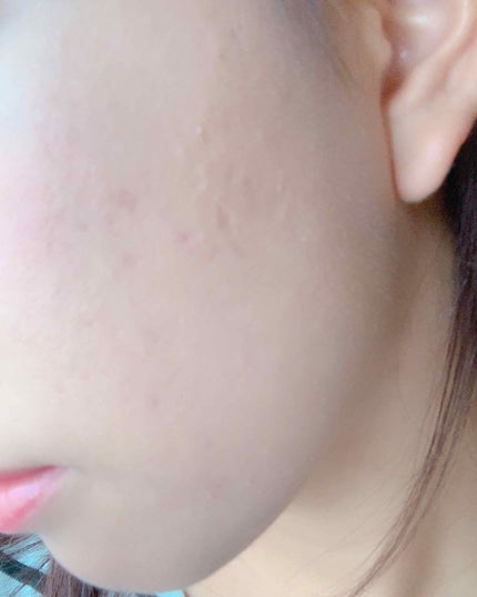 マイファンデーション/innisfree/リキッドファンデーションを使ったクチコミ(4枚目)