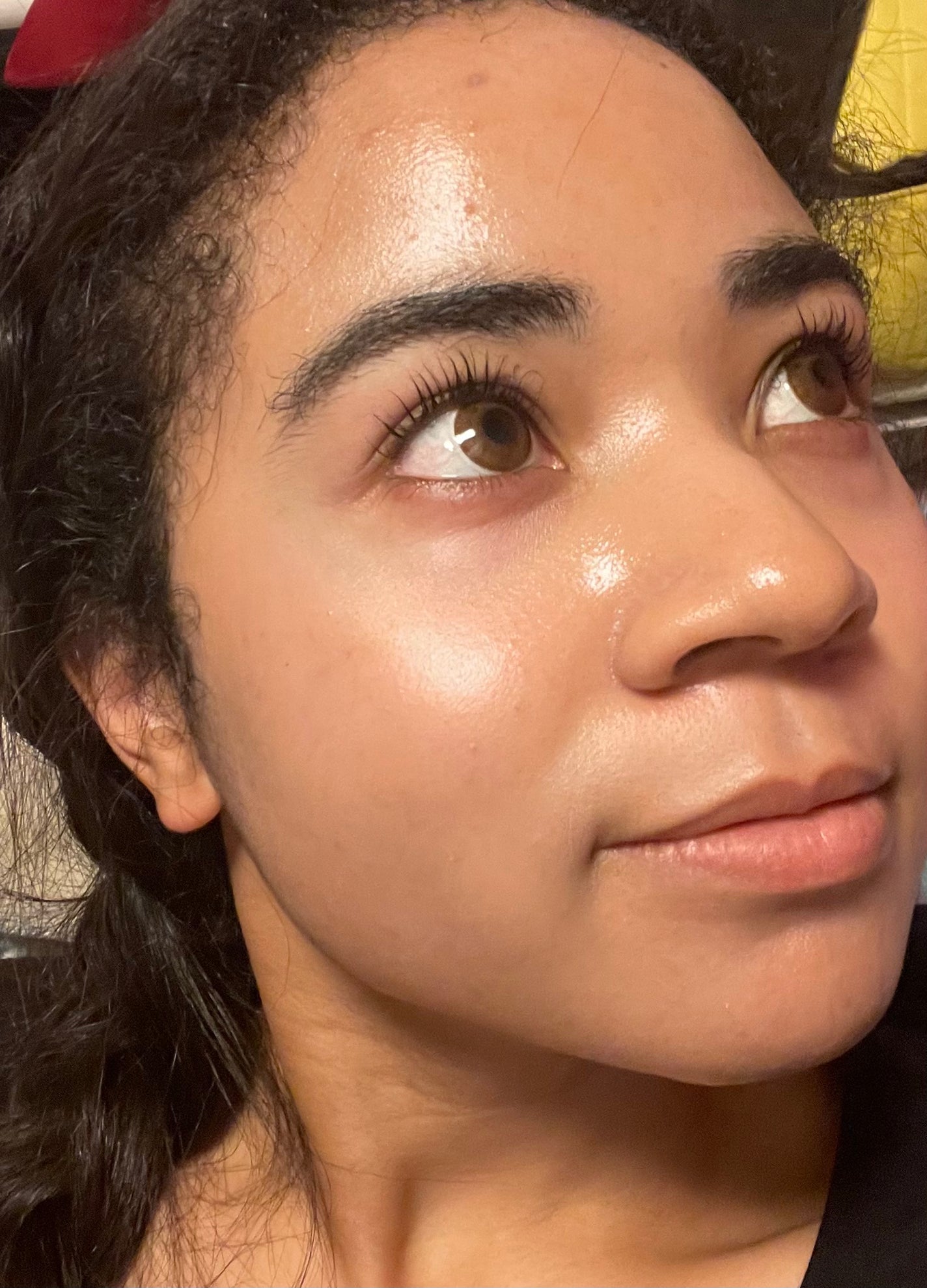 リードルショット300/VT/美容液を使ったクチコミ(2枚目)