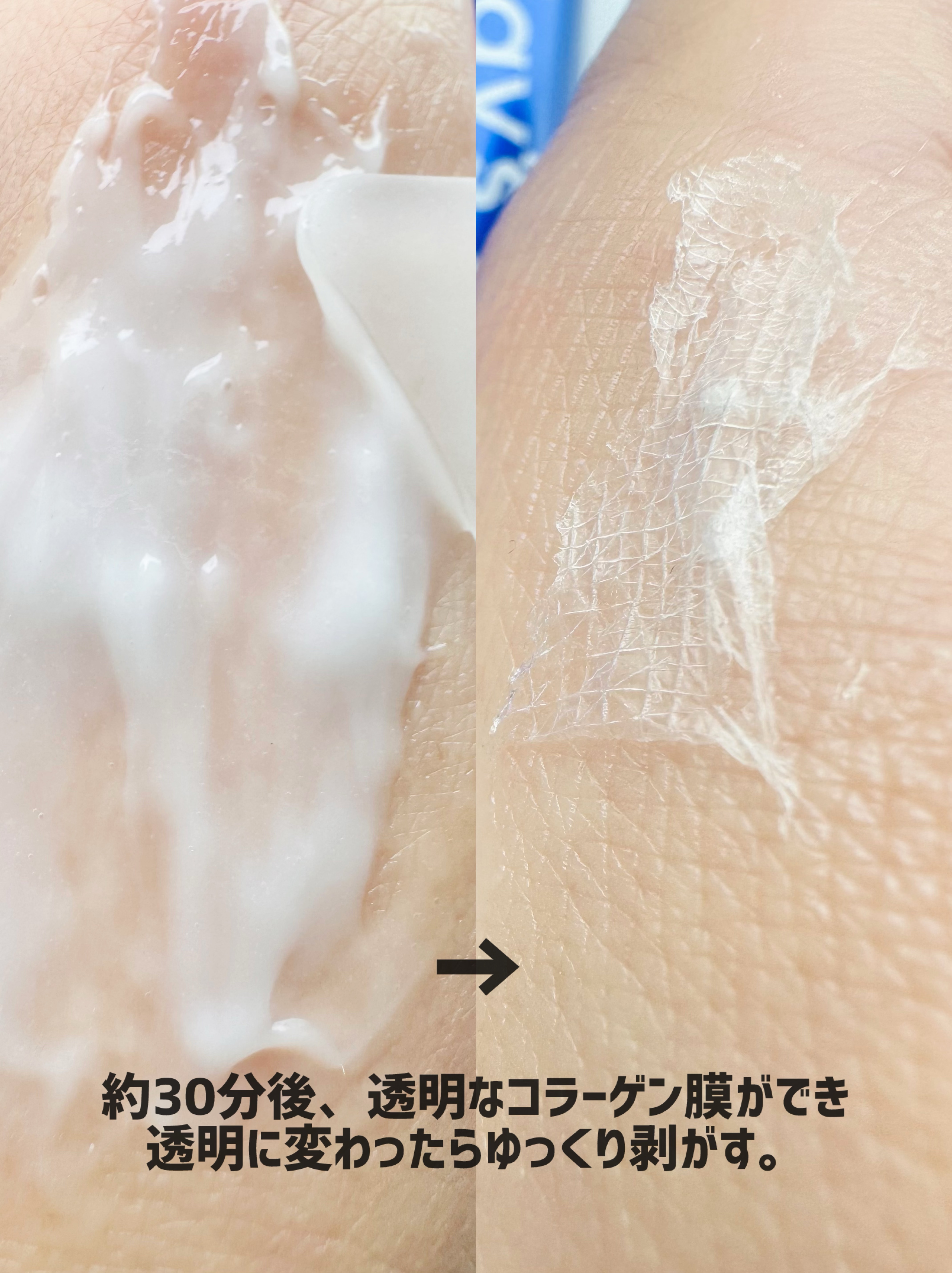 One-day's you ピートピーディーアールエヌ ラッピングショット フィールオフマスクのクチコミ「˗ˋ 𝐎𝐧𝐞-𝐝𝐚𝐲'𝐬 𝐲𝐨𝐮 PDRNピールオフマスク🪡ˊ˗ 
PHYTO-PDRN WR.....」（3枚目）