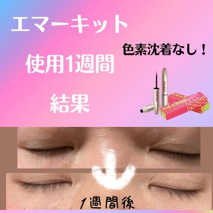 EMAKED(エマーキット)/水橋保寿堂製薬/まつげ美容液を使ったクチコミ(1枚目)