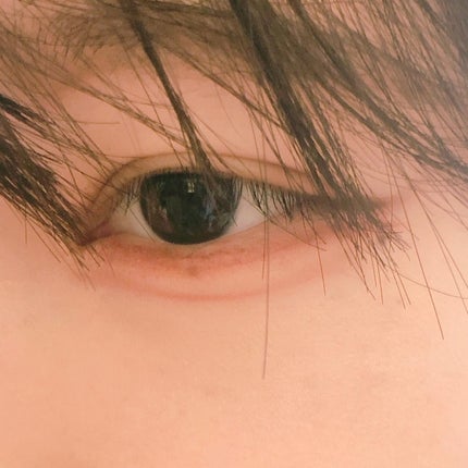 メザイク イージークリア 接着クリアタイプ/メザイク/二重まぶた用アイテムを使ったクチコミ(5枚目)