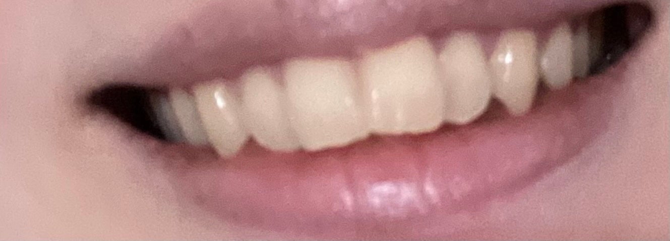 ホワイトニングパウダー ミント/Dr.Oral/歯磨き粉を使ったクチコミ(4枚目)