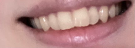 ホワイトニングパウダー ミント/Dr.Oral/歯磨き粉を使ったクチコミ(4枚目)