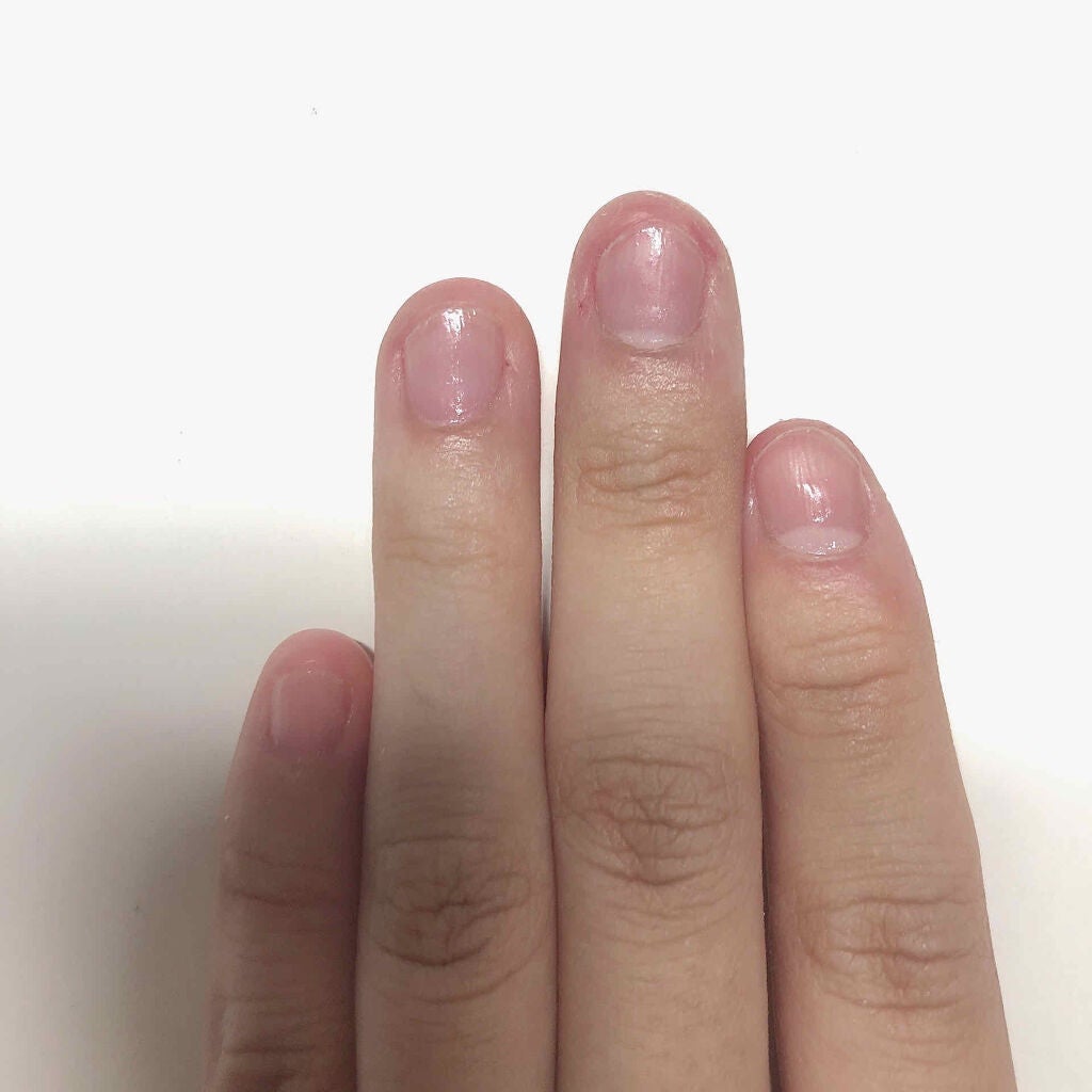 ネイルサポート Na/ネイルネイル/ネイルトップコートを使ったクチコミ(2枚目)