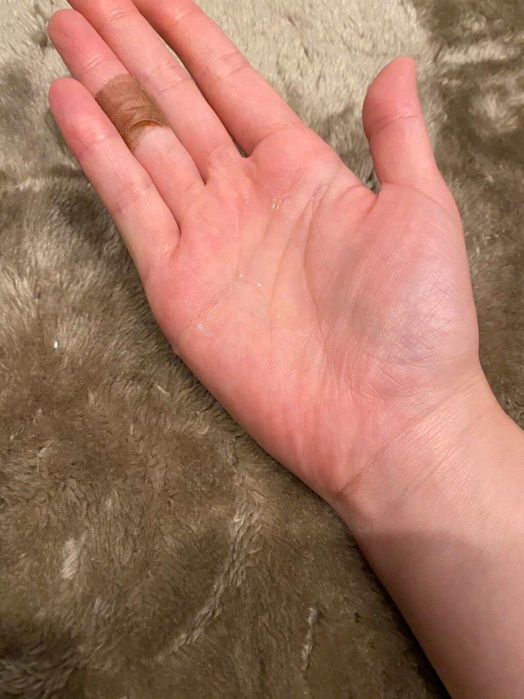 VC100エッセンスローション EX/ドクターシーラボⓇ/化粧水を使ったクチコミ(3枚目)