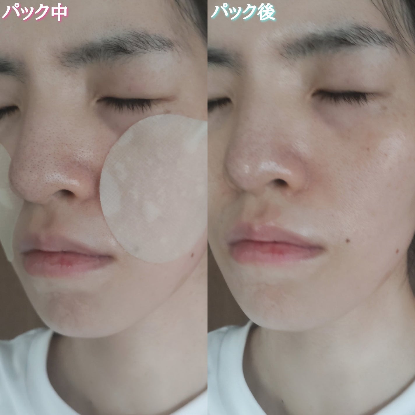 ポストアルファシカクーリングパッド/Cell Fusion C(セルフュージョンシー)/トナーパッドを使ったクチコミ(7枚目)