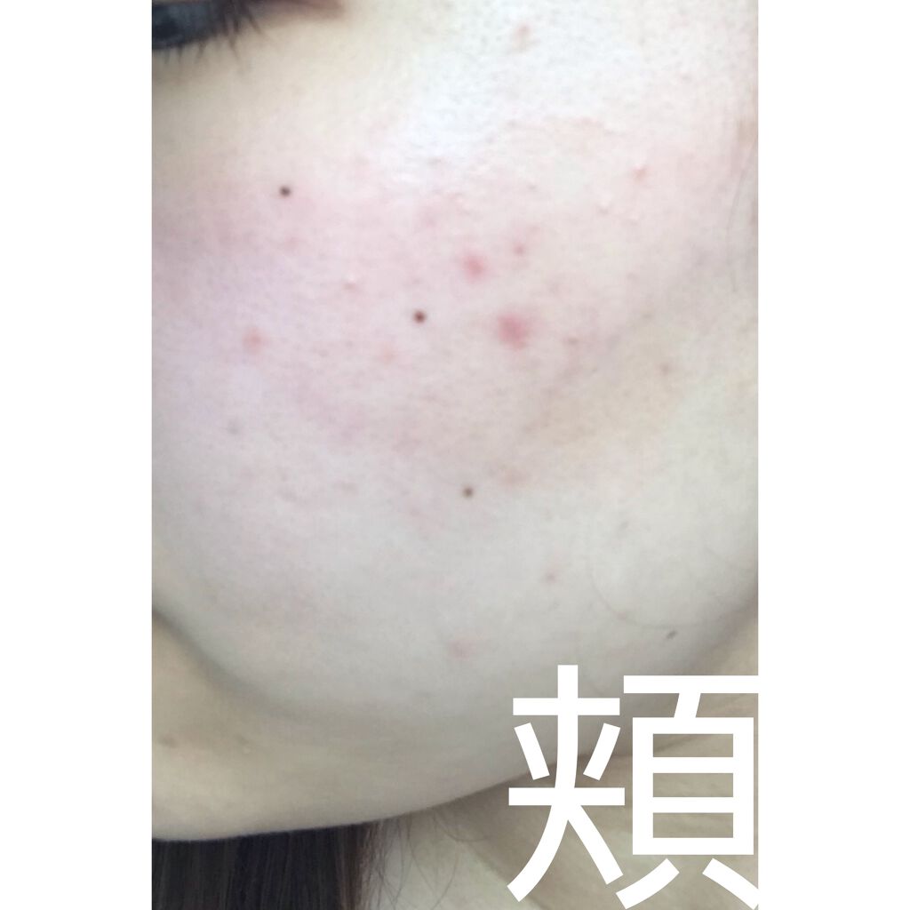 サンシビオ エイチツーオー D/ビオデルマ/クレンジングウォーターを使ったクチコミ(4枚目)