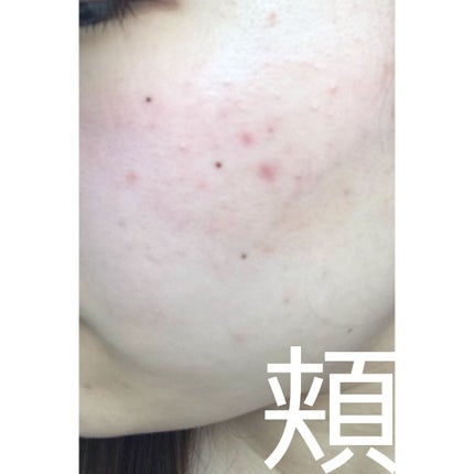 サンシビオ エイチツーオー D/ビオデルマ/クレンジングウォーターを使ったクチコミ(4枚目)