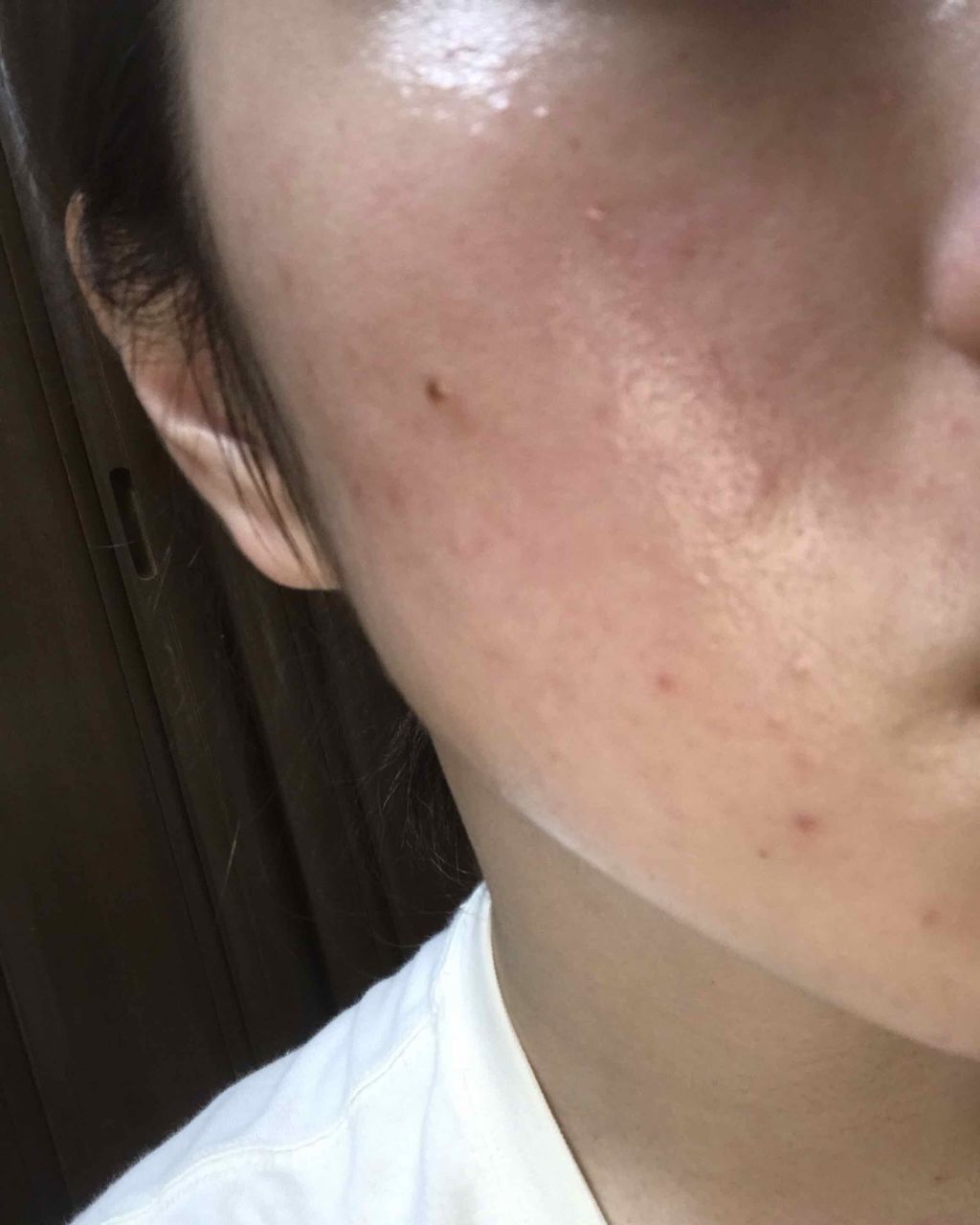 敏感肌用薬用美白美容液/無印良品/美容液を使ったクチコミ（2枚目）