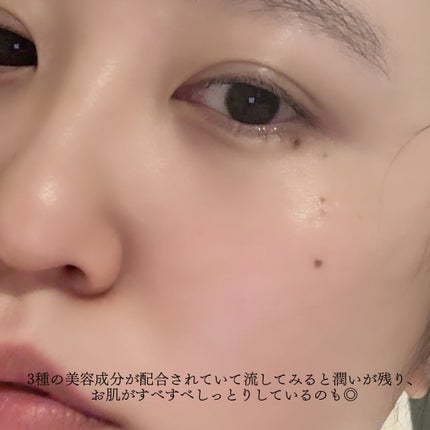 セラムクレンジングオイル/ビフェスタ/オイルクレンジングを使ったクチコミ(6枚目)