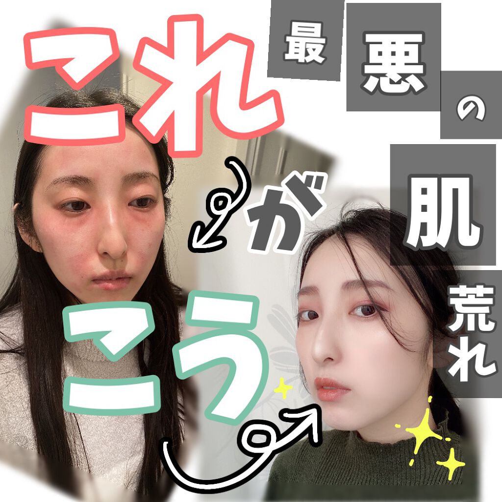 試してみた】ザ・コンセントレート/DE LA MERのリアルな口コミ ...