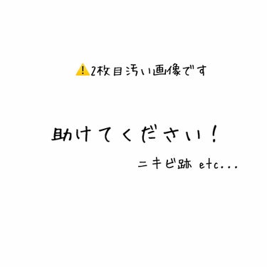 薬用しみ対策 保湿クリーム/メラノCC/フェイスクリームを使ったクチコミ（1枚目）