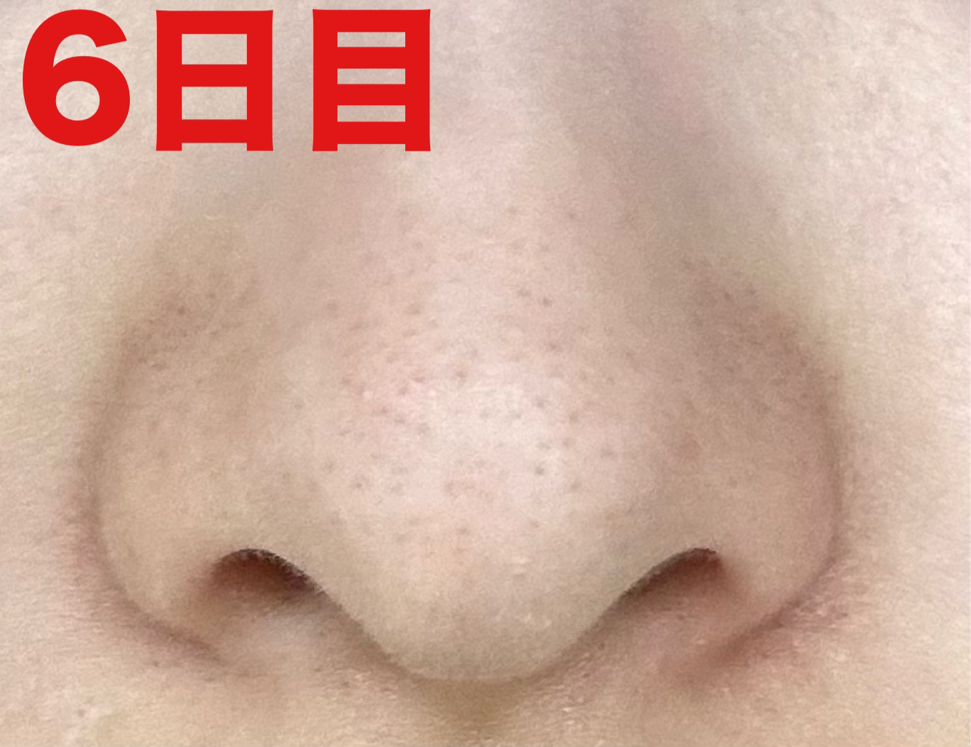 薬用 しみ 集中対策 美容液/メラノCC/美容液を使ったクチコミ（2枚目）