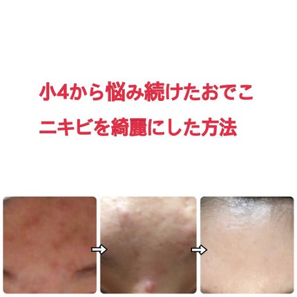 化粧水・敏感肌用・高保湿タイプ/無印良品/化粧水を使ったクチコミ(1枚目)