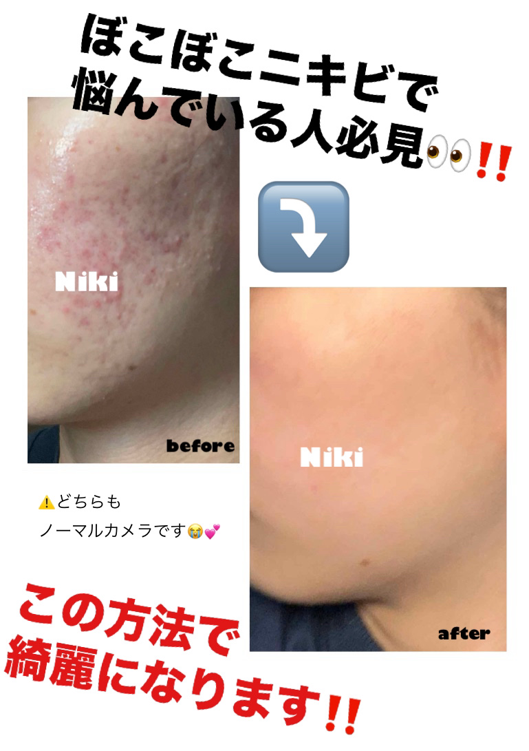 薬用しみ対策 美白化粧水/メラノCC/化粧水を使ったクチコミ（1枚目）