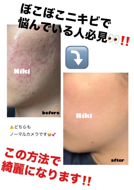 薬用しみ対策 美白化粧水/メラノCC/化粧水を使ったクチコミ(1枚目)