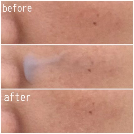 ペプチド ボリューム マスター エッセンス/DR.PEPTI/美容液を使ったクチコミ(4枚目)