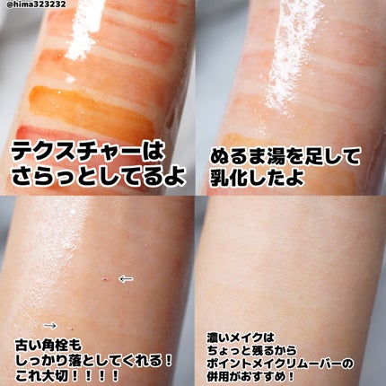 ひまちゃん /垢抜けの参考書 on LIPS 「他の投稿もみてね😚▶︎@hima323232【肌ケア】〜ニキビ..」(4枚目)