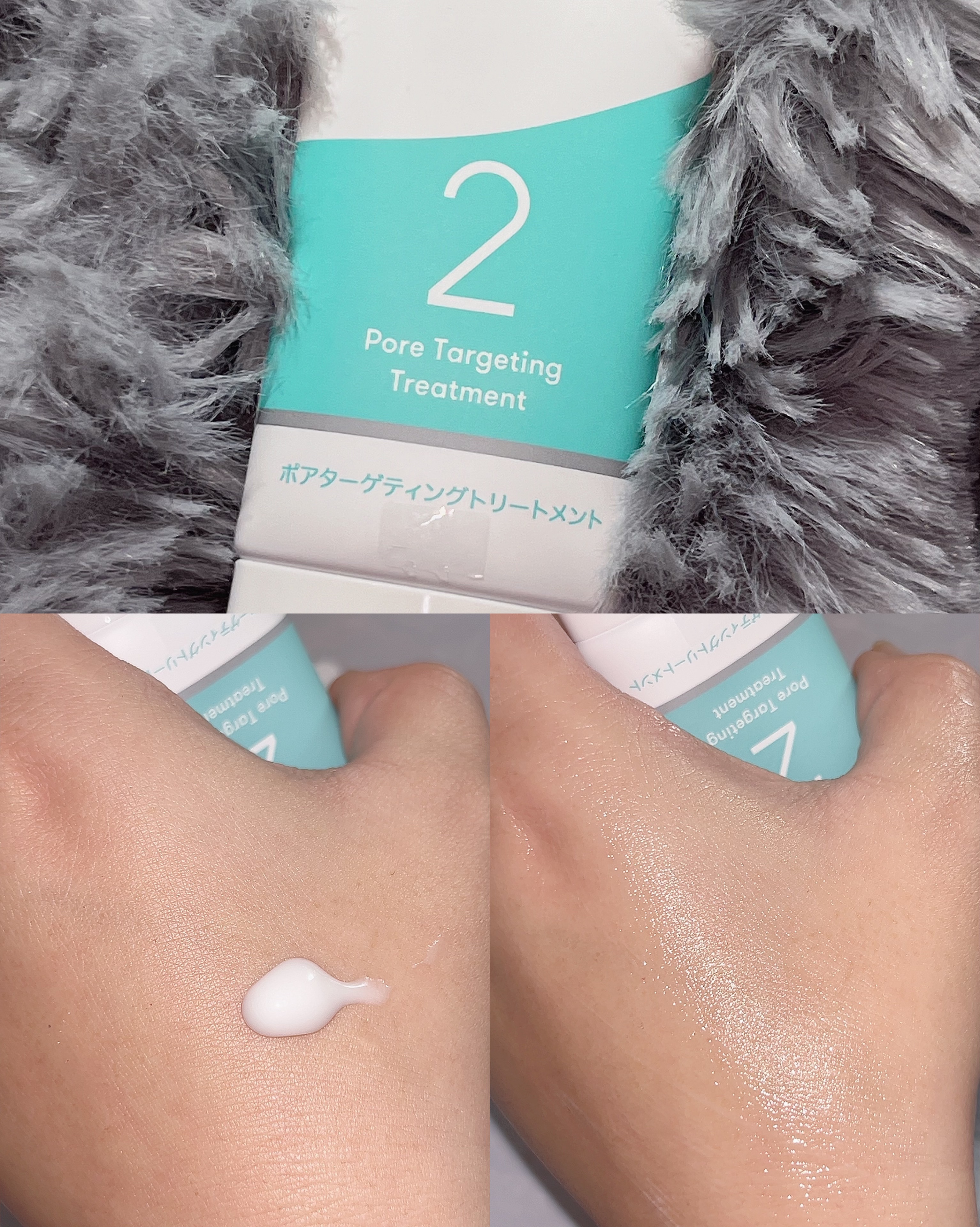 スマートセット/プロアクティブ/スキンケアキットを使ったクチコミ（3枚目）