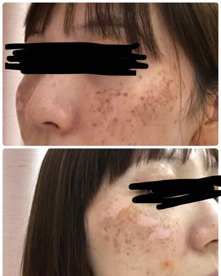 を使ったクチコミ(2枚目)