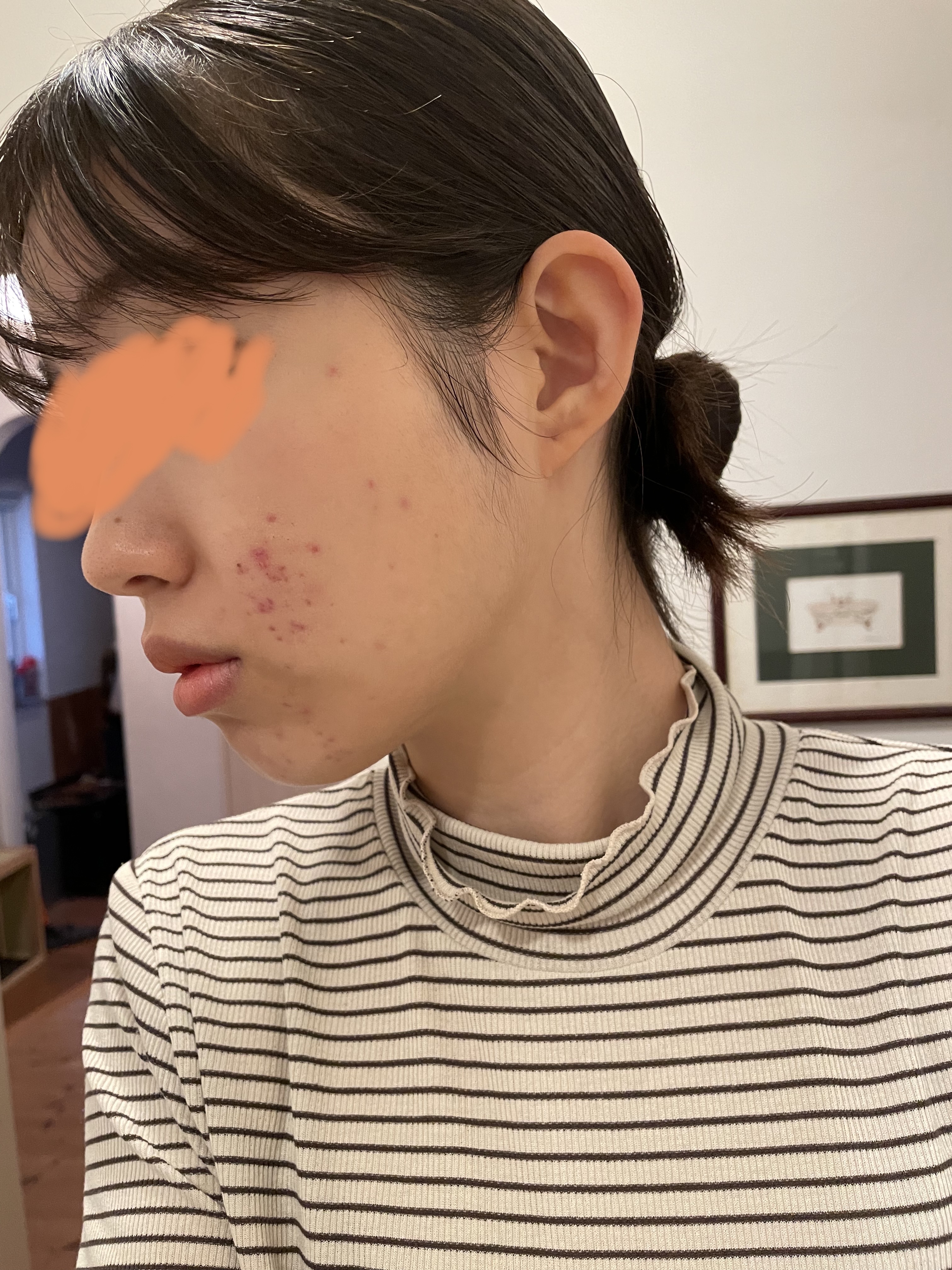 薬用泡洗顔/なめらか本舗/泡洗顔を使ったクチコミ（1枚目）