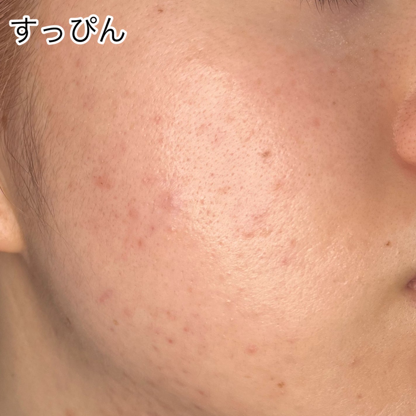 UVイデア XL プロテクショントーンアップ ローズ/ラ ロッシュ ポゼ/日焼け止めクリームを使ったクチコミ(3枚目)