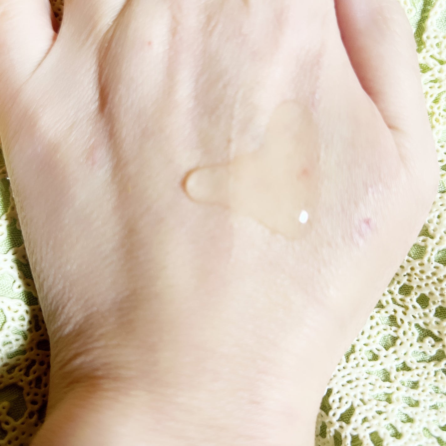 タカミスキンピール/タカミ/ブースター・導入液を使ったクチコミ(3枚目)