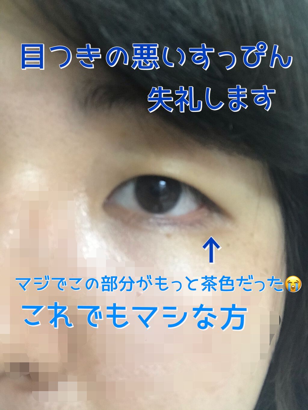 薬用 しみ 集中対策 美容液/メラノCC/美容液を使ったクチコミ（2枚目）