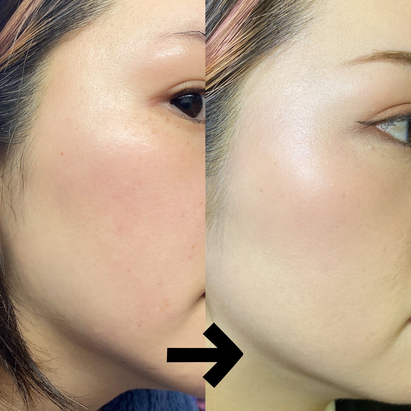 ピンクダイヤクッション/4YE/クッションファンデーションを使ったクチコミ(6枚目)