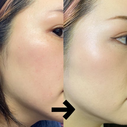 ピンクダイヤクッション/4YE/クッションファンデーションを使ったクチコミ(6枚目)