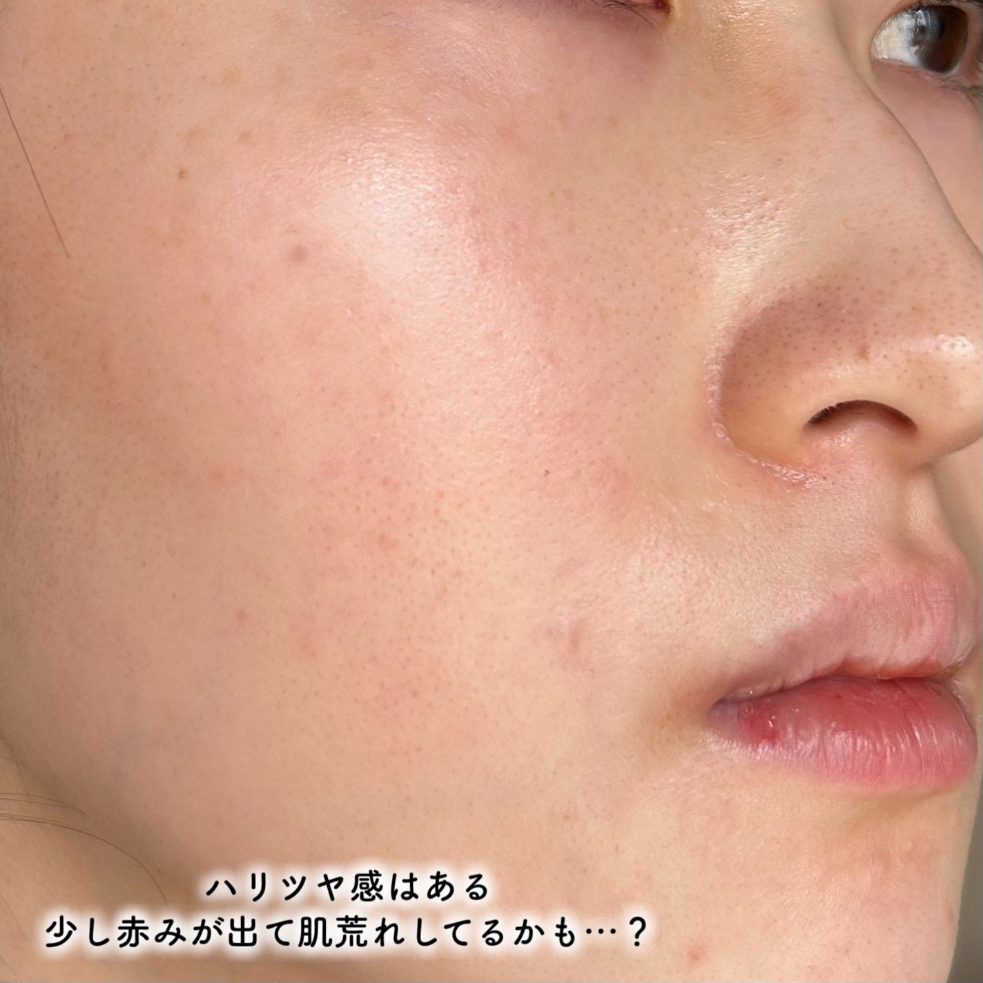 RTXセラム ぺプチショット/Dr.G/美容液を使ったクチコミ(4枚目)