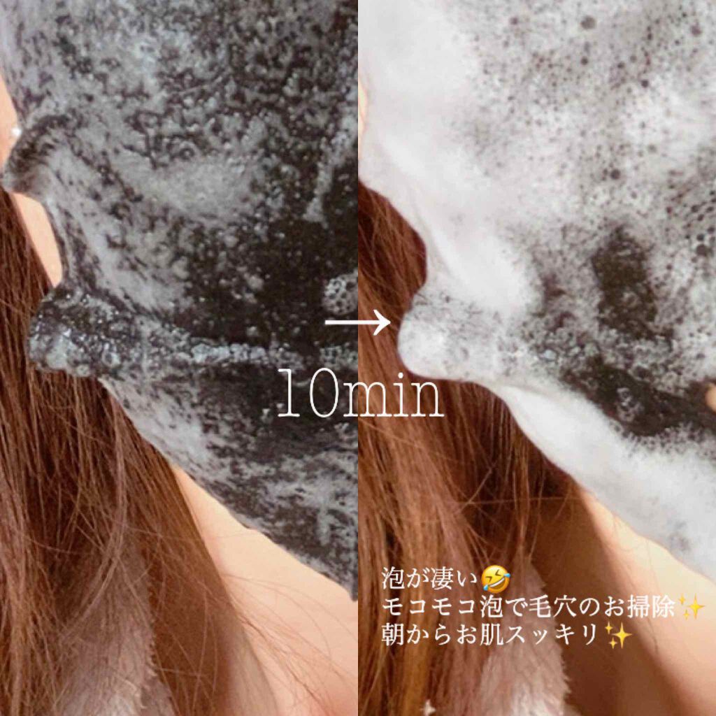 炭酸バブルシート/MEDIHEAL/シートマスク・パックを使ったクチコミ(2枚目)