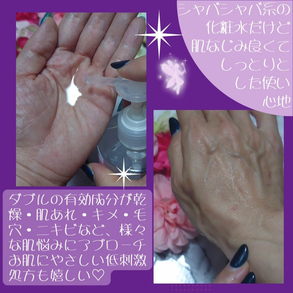 ヘパトリート 薬用保湿化粧水/ゼトックスタイル/化粧水を使ったクチコミ（3枚目）